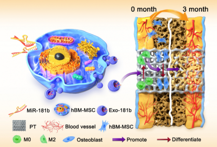 J Nanobiotechnology：上海长征医院杨立利课题组发现工程化的外泌体miR-181b通过调节巨噬细胞极化改善骨整合