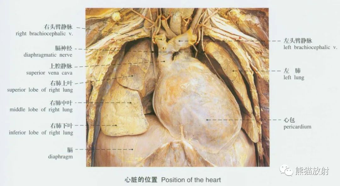 系统解剖标本图谱丨心脏、动脉血管系统~