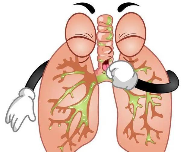 镰状细胞病肺动脉高压是怎么回事？