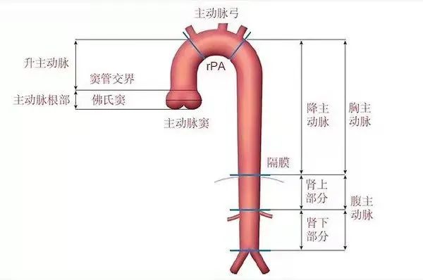 stanforda型主动脉夹层外科手术麻醉中国专家临床路径管理共识