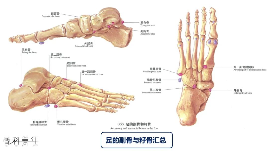 多图详解｜足部骨性解剖与常见副骨