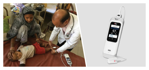 印度大规模现场试验显示，Masimo Rad-G®可帮助临床工作者识别小儿肺炎