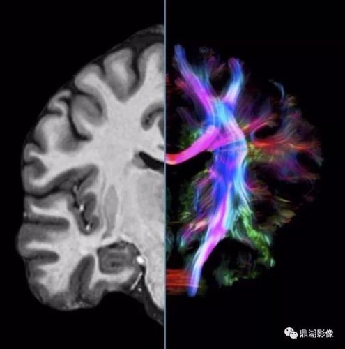 Human Brain Mapping：用超高场7T静息态fMRI可评估静息态核心网络中自发脑活动的稳定性和功能连接
