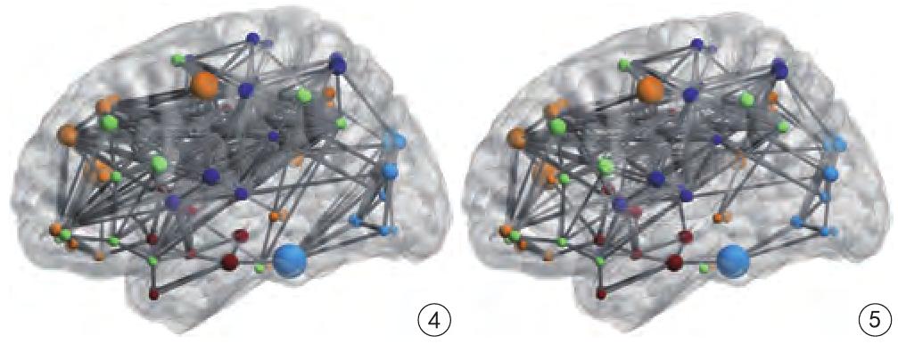 NeuroImage：动态模态分解可从<font color="red">rs</font>-fMRI数据中提取时空特征预测行为