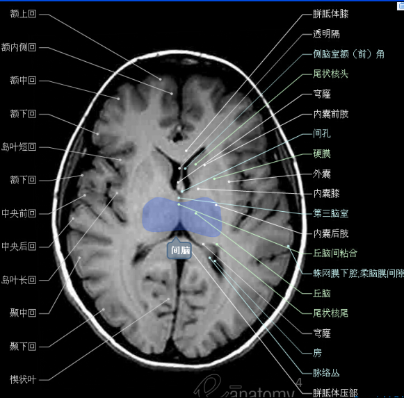 脑血管mra解剖图图片