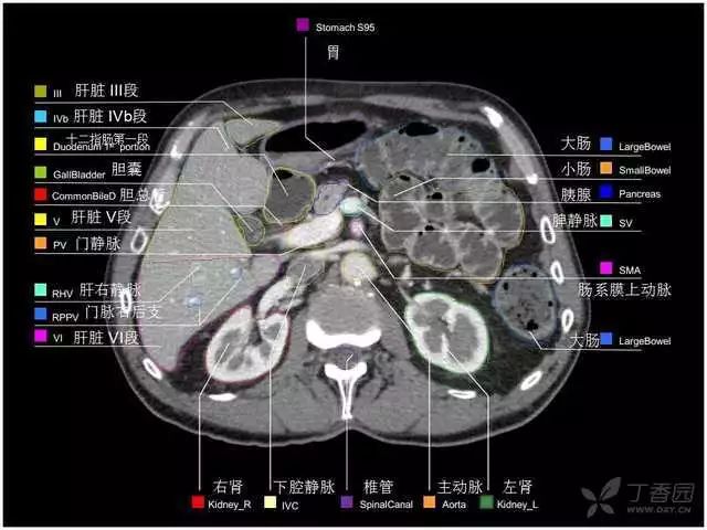 髂外静脉ct解剖图图片