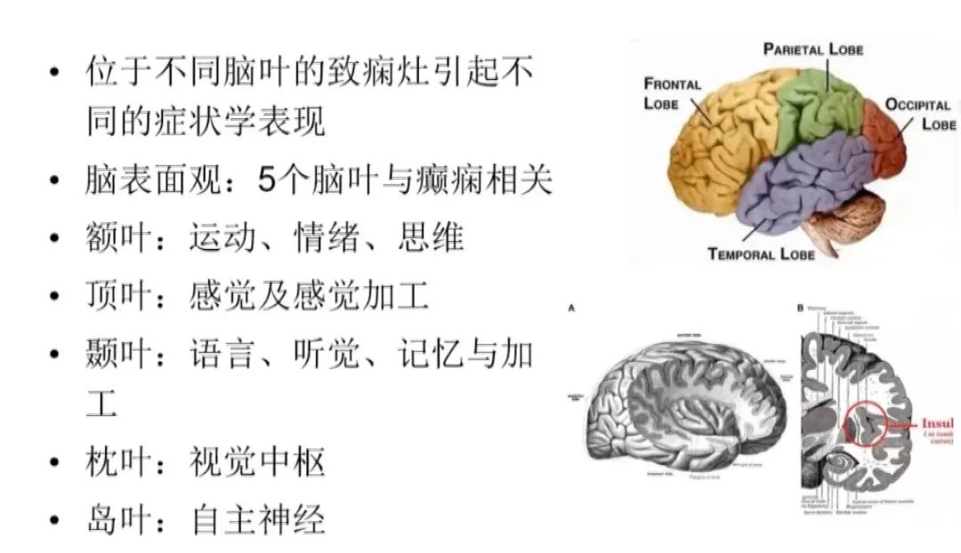 5种脑叶癫痫病症状学定位总结，一文掌握！
