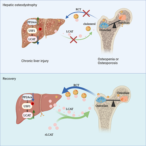 Cell Metab：肝骨轴缺陷促进肝性骨营养不良疾病的发生机制