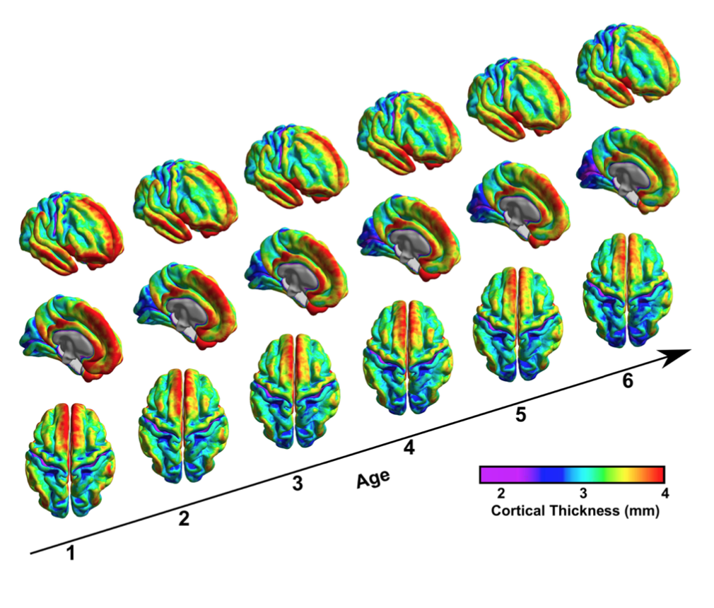 NeuroImage：我国科学家首次绘制<font color="red">脑</font>发育黄金期<font color="red">生长</font>曲线