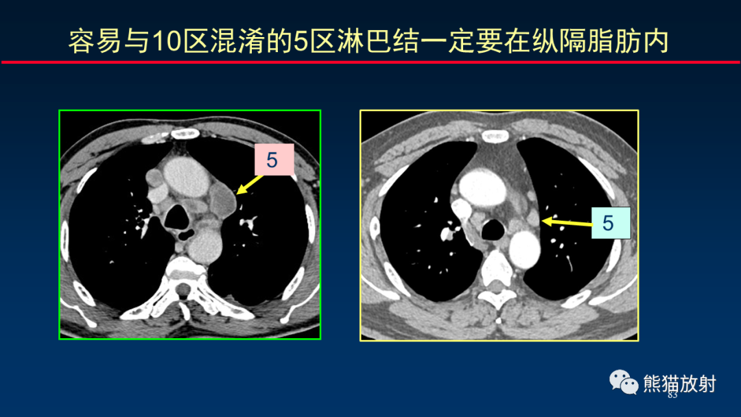 纵隔淋巴结位置图CT图片