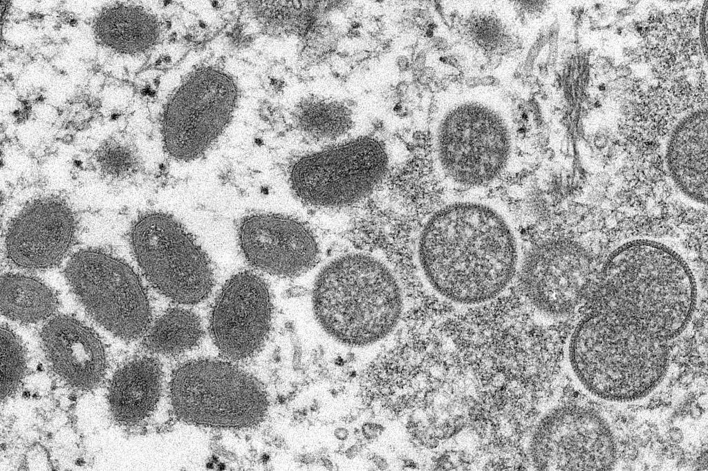 猴痘：会成为下一场全球大流行病吗？有10个问题您应该知道