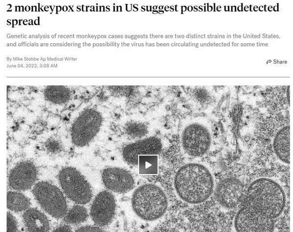 CDC:两种猴痘病毒可能在美国失控传播