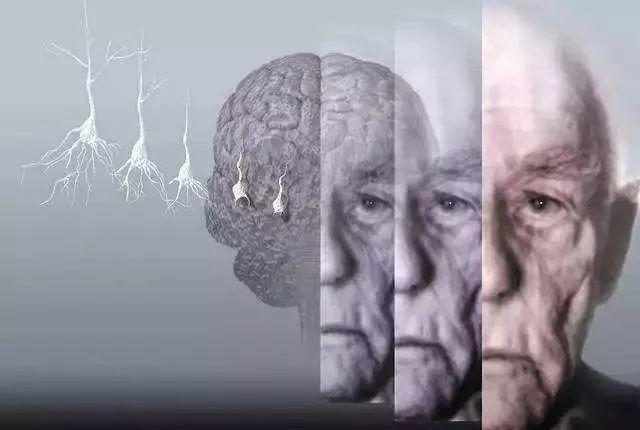Alzheimer’s & Dementia：临床<font color="red">前</font>阶段<font color="red">前</font>6年认知功能下降速率有助于评估随后6年痴呆患病率