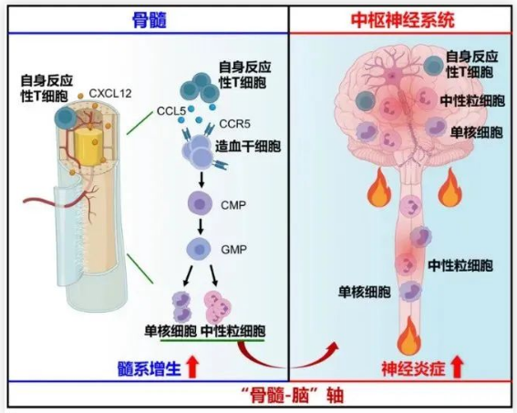 Cell：天津医大学者证实<font color="red">骨髓</font>免疫可能是多发性硬化症的关键