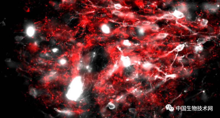 Cell Rep：哈佛科学家揭示“恶心”的神经生物学机制