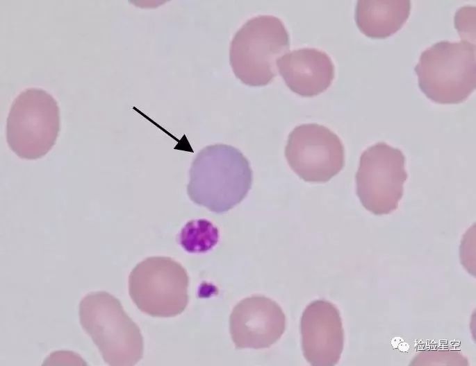 【基本<font color="red">功</font>测验】这些常见血液细胞形态，你认得哪些？