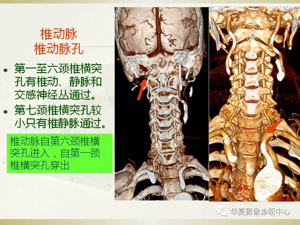 颈椎病影像<font color="red">诊断</font>及临床<font color="red">分</font><font color="red">型</font>