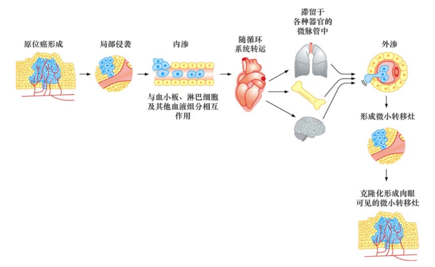 <font color="red">肿瘤</font>生物学：（13）<font color="red">肿瘤</font>的<font color="red">侵袭</font>和转移