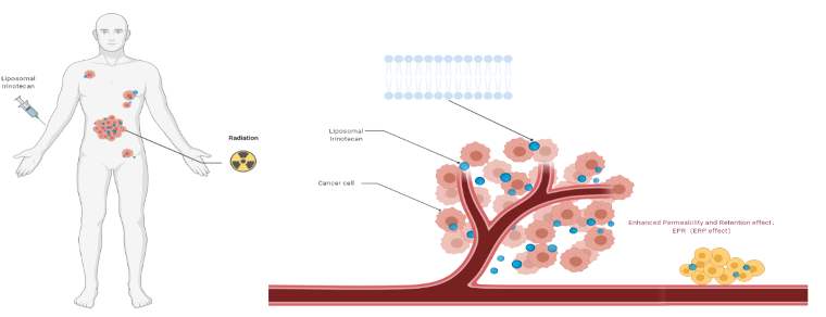 肺腺癌IV期的免疫整合治疗方式：<font color="red">CAP</font>方案原理介绍与病例分享