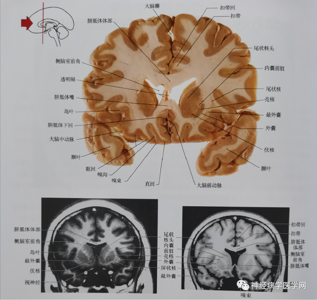 临床神经解剖图谱（断层影像+切片）