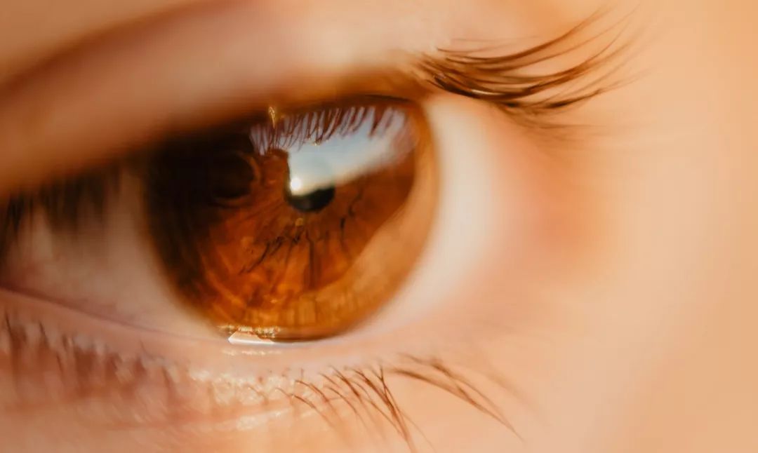 眼红、畏光、疼痛、<font color="red">视力</font>减退，警惕强直并发症：虹膜炎！