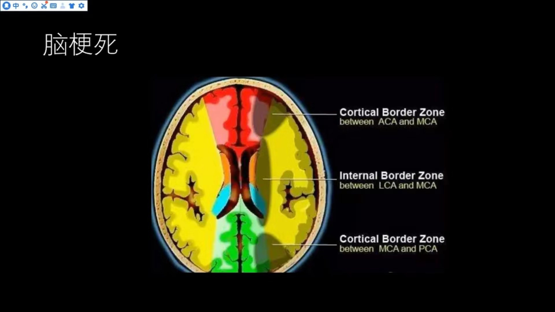 常见<font color="red">脑血管</font>疾病的MRI表现