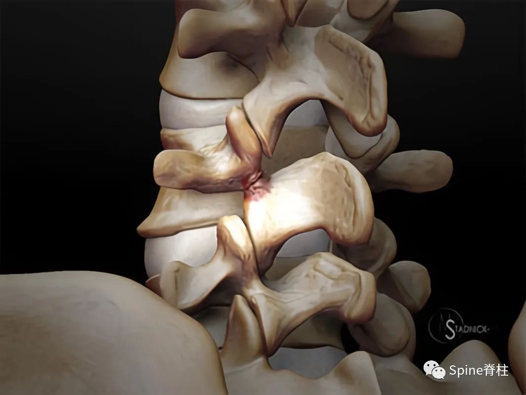 Nature Reviews Neurology：从影像学角度了解脊髓损伤病理 - 知乎