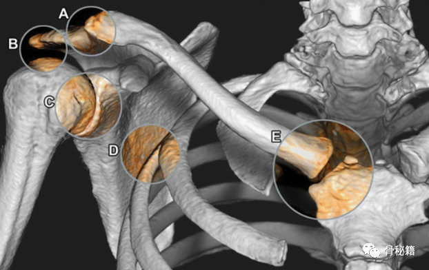 肩锁关节解剖详解与影像