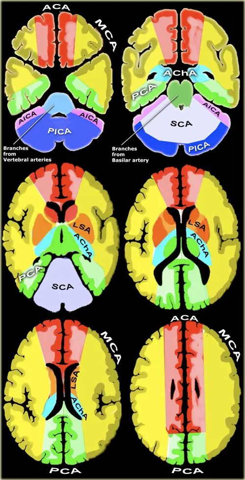 脑血管供血<font color="red">分布图</font>文详解 及 常见脑血管疾病的MRI表现