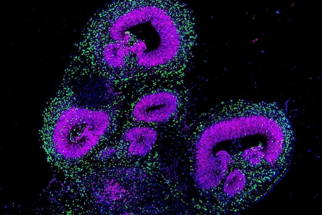 Nature：繪制人類大腦類器官發(fā)育的多組學圖譜