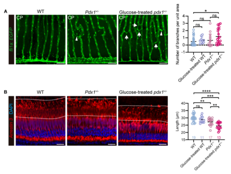 J Neurosci：糖尿病性视网膜病变可能与hcn1基因功能有关