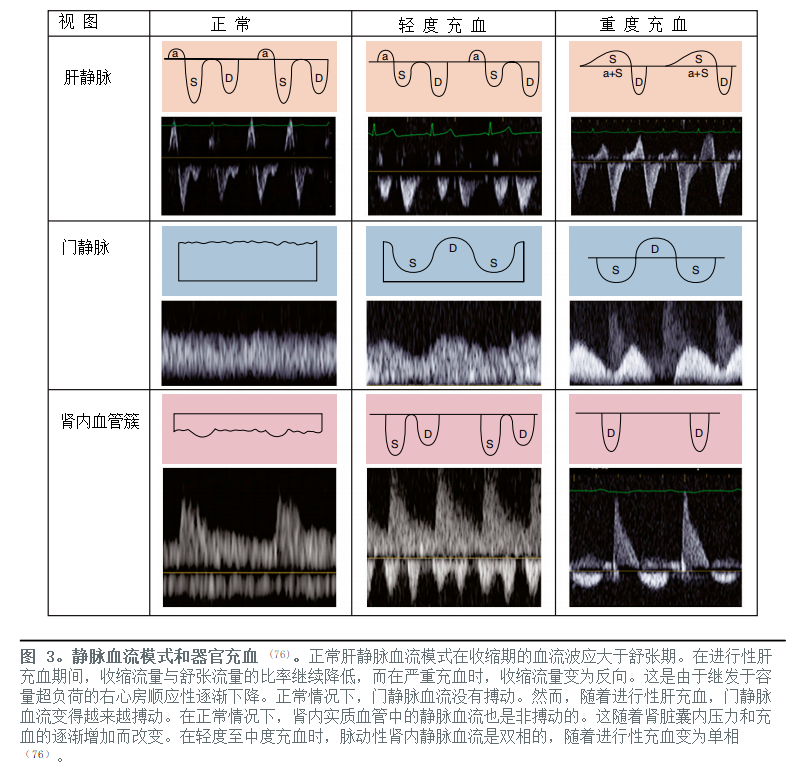 重症学者对休克、容量管理及<font color="red">血流动力学监测</font>的展望