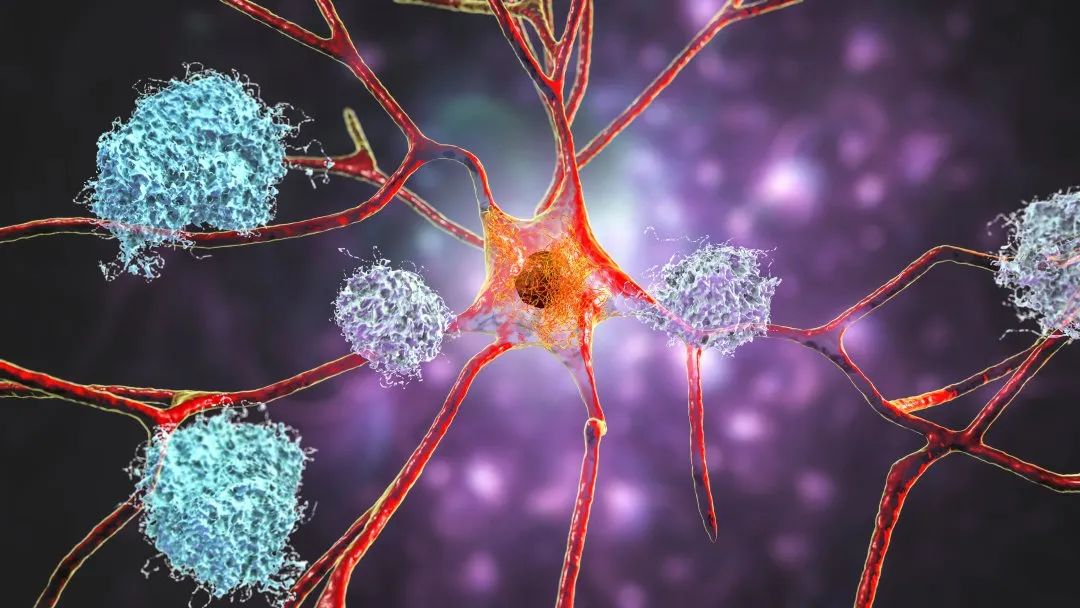 参与<font color="red">神经元</font>结构和功能的基因可以预防阿尔茨海默病