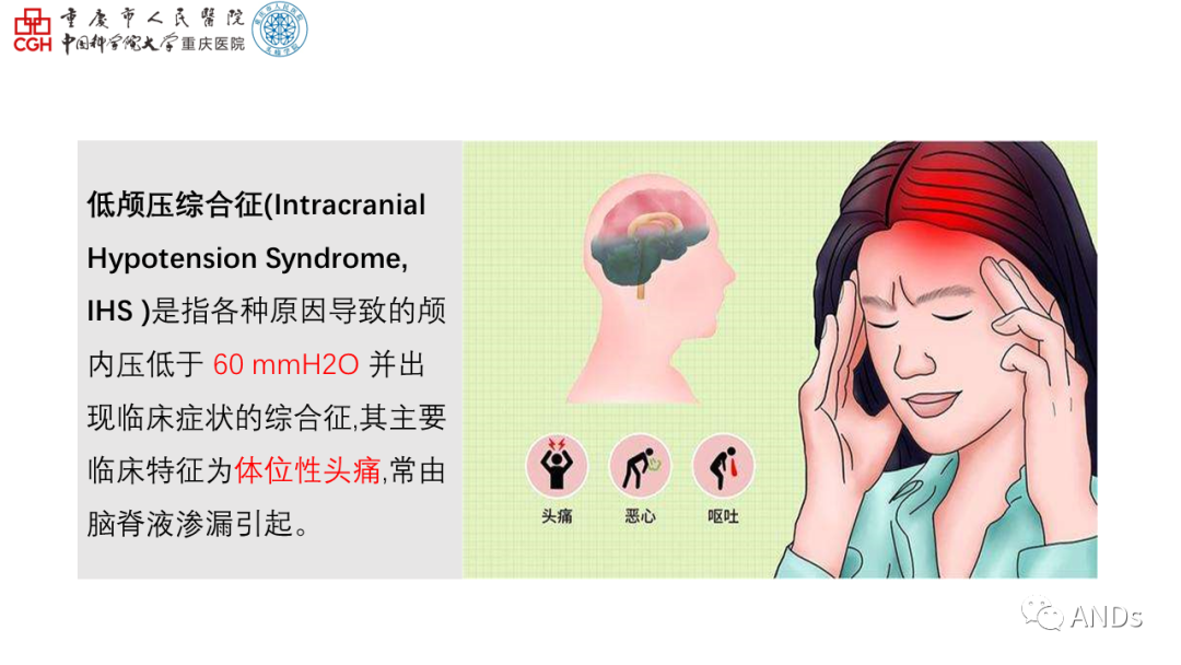 <font color="red">自体</font>硬膜外血贴治疗低颅压性头痛