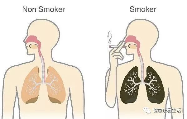 什么是慢阻肺？形成的具体原因有哪些？