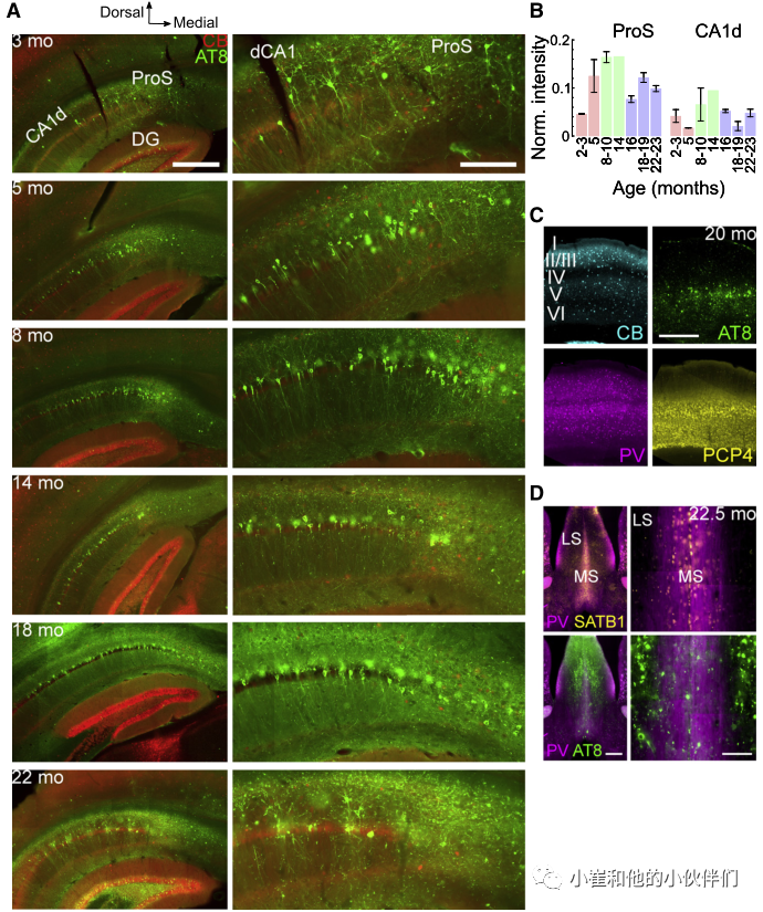 Cell Reports：衰老小鼠中病理性Tau从神经元扩散到少突胶质细胞