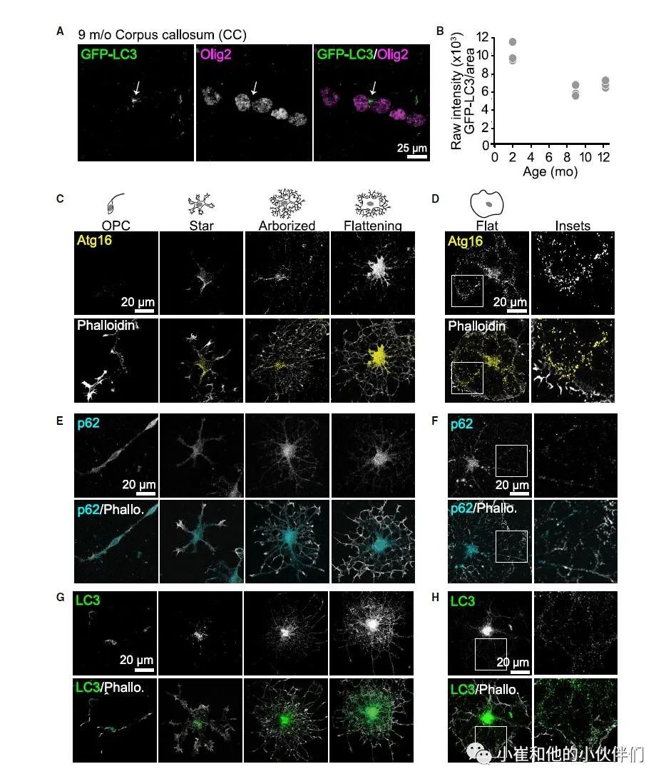 Cell Reports: 少突胶质细胞的巨自噬性髓鞘周转在神经退行性疾病中的作用