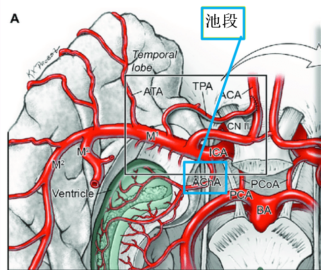 脉络膜<font color="red">前</font>动脉＆脉络膜后动脉