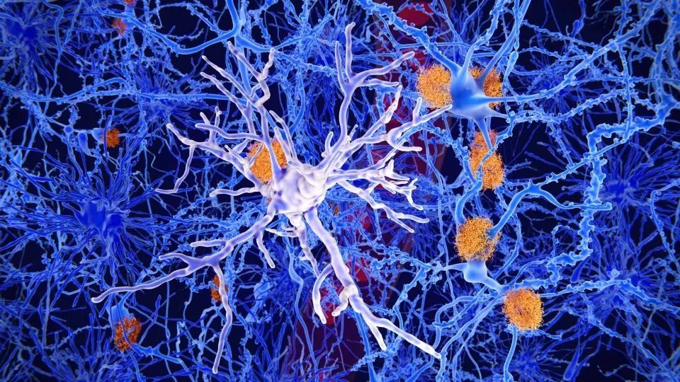 大脑的免疫细胞可以被触发来减缓阿尔茨海默病