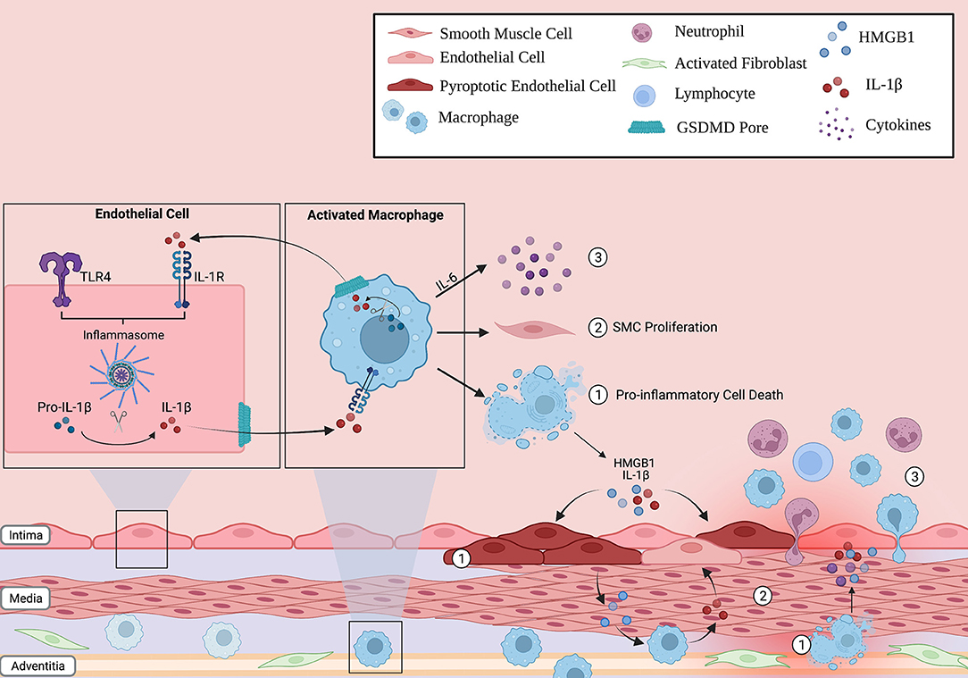 Frontiers | Inflammasome Activation in Pulmonary Arterial Hypertension
