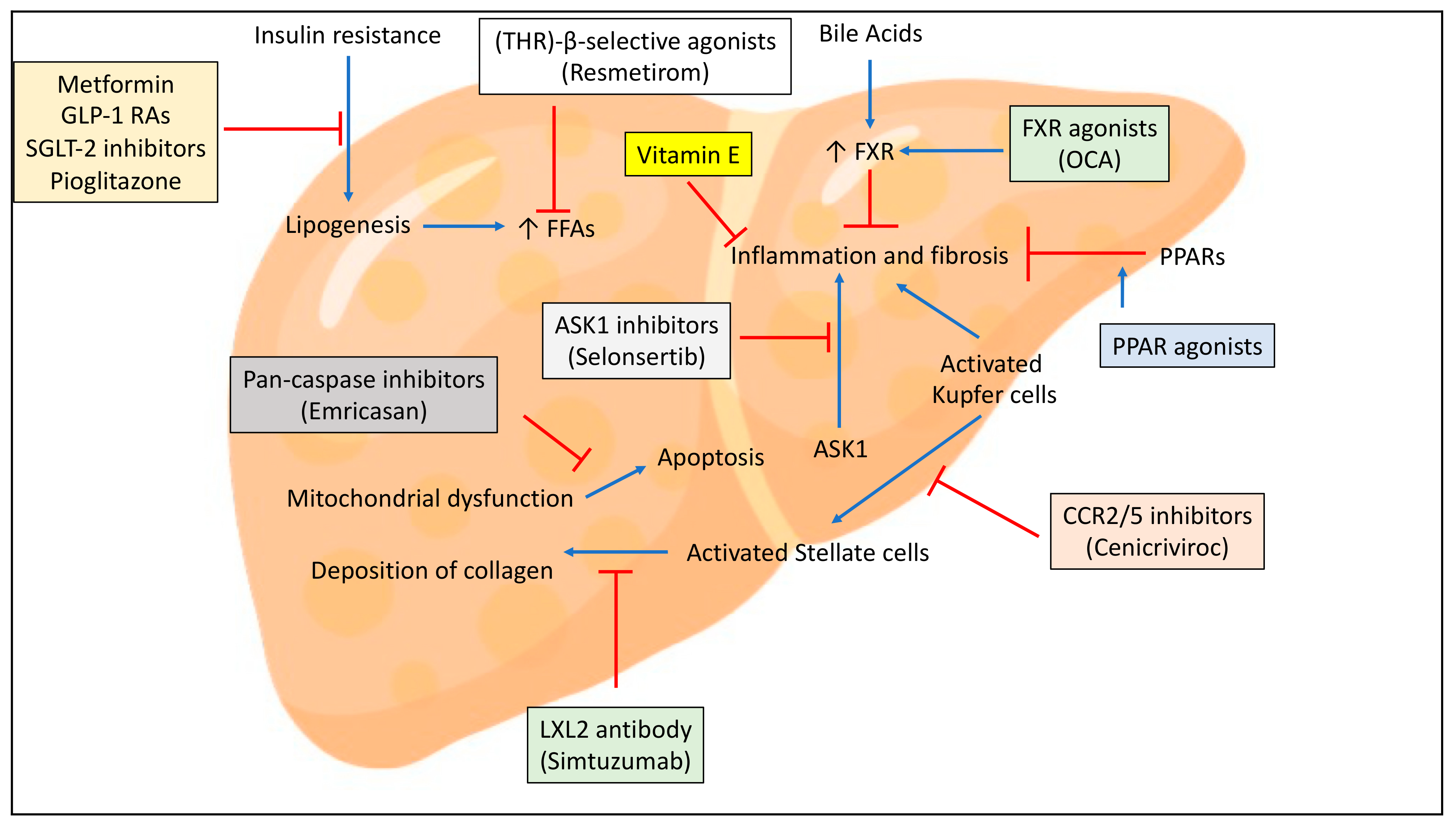 IJMS | Free Full-Text | Treatments for NAFLD: State of Art