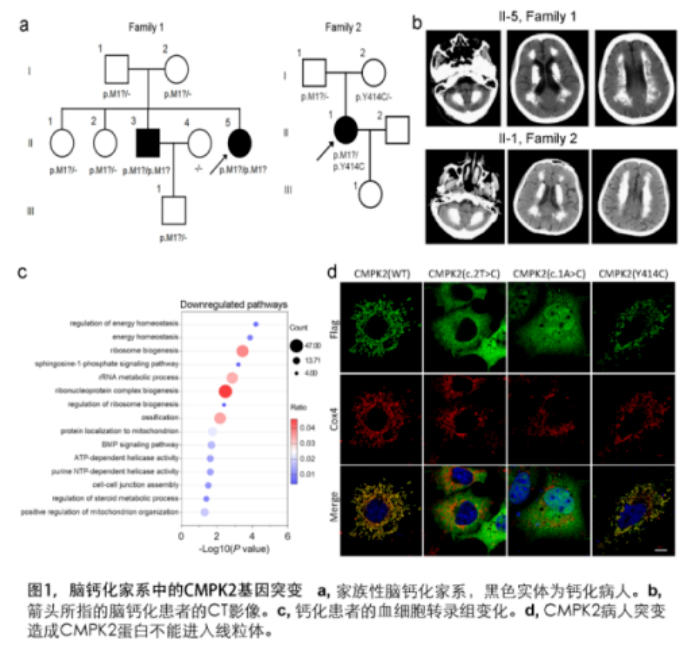 研究揭示CMPK2基因缺陷导致线粒体障碍和家族性脑钙化<font color="red">症</font>