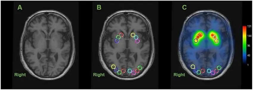 Front Aging Neurosci：纹状体<font color="red">多巴胺</font>能神经元与认知和衰老的“爱恨情仇”