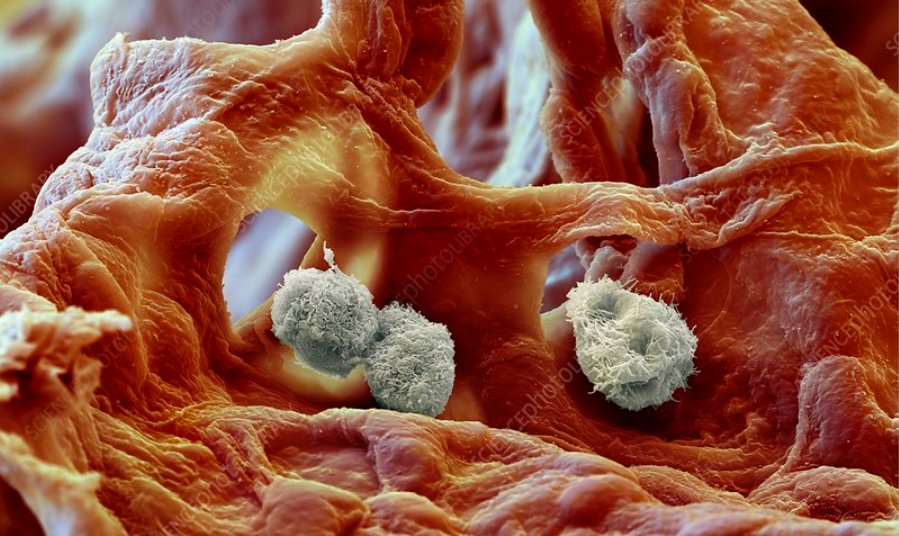 Nature子刊：其实巨噬细胞的专业并不简单