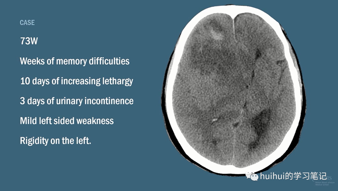颅脑影像学读片教程（CT+MRI）