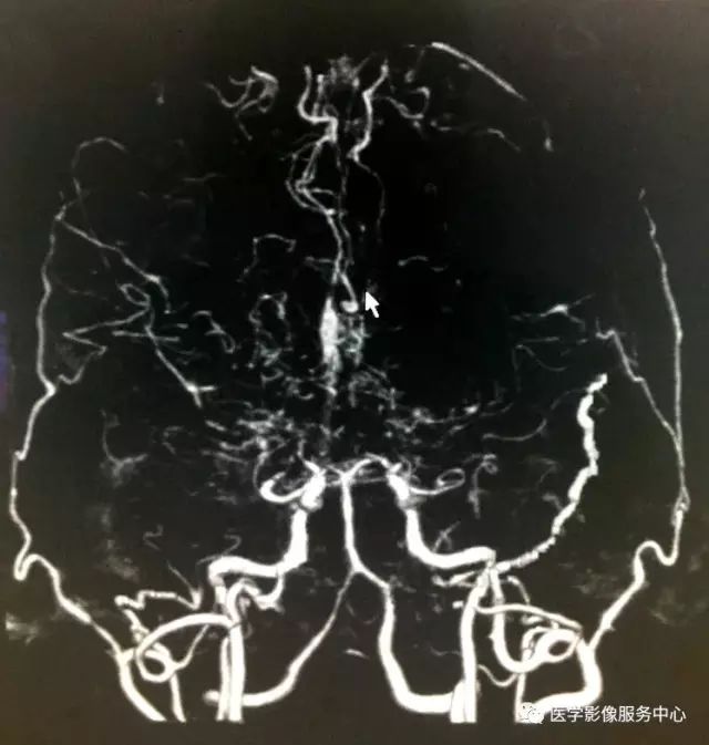 僅憑一層CT圖像即可確診此類疾病