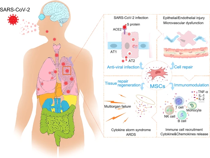 全球長(zhǎng)新冠患者近1.45億！間充質(zhì)干細(xì)胞有這些作用：改善凝血，控制炎癥，緩解肺損傷...