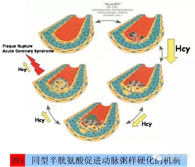 同型半胱氨酸（<font color="red">Hcy</font>）—— 心脑血管疾病检测的优秀指标