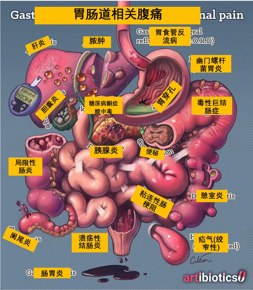 一图了解：腹部<font color="red">因素</font>导致的腹痛原因