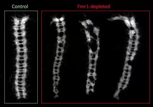 Science揭示：自闭症背后的<font color="red">遗传</font><font color="red">缺陷</font>